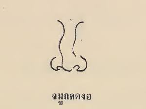 จมูกคดงอ